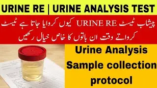 Urine RE test advice | Urine RE test sample protocol | why Doctor advise Urine test | Urine analysis