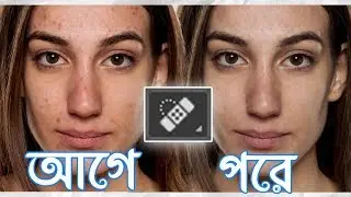Remove PIMPLE MARKS with Photoshop in 5 MINUTES! | Photoshop Tutorial | Bangla 2017