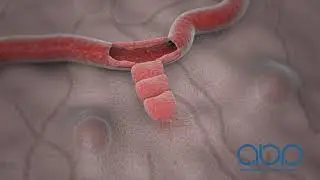 Blood Vessels Regenerating -  3D Medical Animation || ABP ©