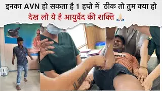 AVN ADVANCE STAGE - बांग्लादेश से आये दर्द में 1 हप्ते में किया पूरा ठीक | Dr.Amit Bharti Dehradun