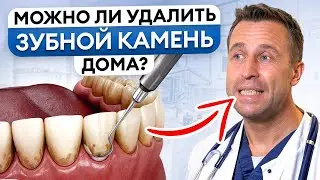 ЛУЧШЕЕ средство от ЗУБНОГО НАЛЕТА! / Как ИЗБАВИТЬСЯ от зубного камня в ДОМАШНИХ УСЛОВИЯХ?