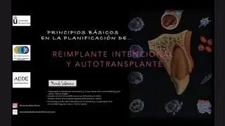 Principios básicos en la Planificación de Reimplante Intencional y Autotransplante