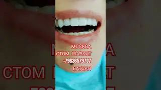 ЦИРКОН КЕРАМИКА ТИШЛАР ! МОСКВА СТОМ ШАВКАТ #moskva #stomatologia #циркон