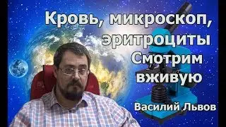 Кровь, микроскоп, эритроциты. Смотрим вживую.