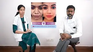 Alarplasty Cost in India | Rhinoplasty Alarplasty Procedure - Dr. Sunil Richardson