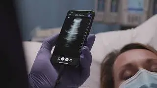 Butterfly iQ+: Bedside Lung Imaging