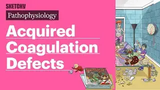 Acquired Coagulation Defects (Pathophysiology) | Sketchy Medical