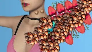 ASMR Remove Dog Ticks | Worm Infected Armpit | Deep Cleaning Animation