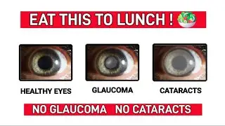 Beat Glaucoma and Cataracts Naturally! Power Up Your Eyes at Lunch #health #food  @Happyside1