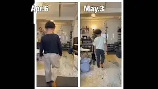 Duchenne muscular dystrophy after 1 month