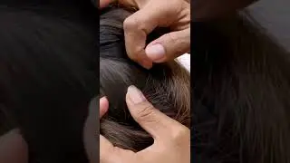 How to Remove Lice from the Hair