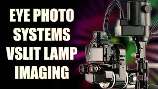 Eye Photo Systems - vSlit Lamp Imaging