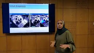 Tetralogy of Fallot (Part 1) - Soha Romeih