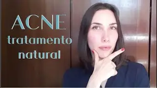 Como Tratar ACNE de forma NATURAL - Tipos de Acne e Tratamentos | Chez Julia