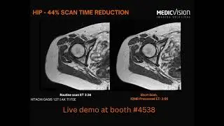 RSNA 2023 - Come to the Medic Vision booth for the latest in AI for Medical Imaging