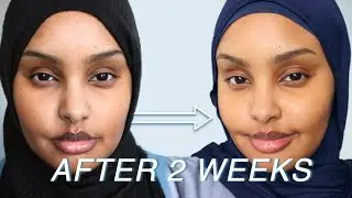 How I Repaired My Skin Barrier In 2 Weeks | Let's Talk Skin | Jasmine Egal