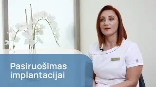 Kaip tinkamai pasiruošti implantacijai?