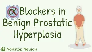 How Alpha Blockers Help in Benign Prostatic Hyperplasia?