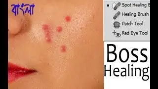 Photoshop Tutorial || Healing Brush tool Use in Bangla