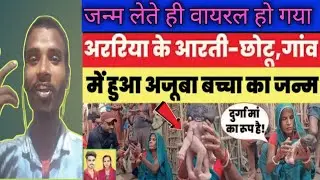 अररिया में अजूबा बच्चा का हुआ जन्म , सबलोग भगवान क्यों मानने लगे..?Area news |dhobi brand reaction
