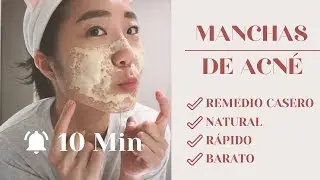 CÓMO ELIMINAR LAS MANCHAS DEL ACNÉ EN 10 MIN | Ana la Coreana
