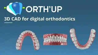 ORTH'UP | Cutting-edge treatment planning software