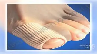 болезни пальцев стопы

  - Valgus Pro - средство от выпирающей «косточки»