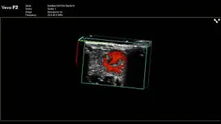 Kidney Vessel Branching
