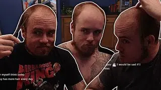Proving My Baldness by Growing Out My Hair