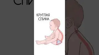 Круглая спина. Что делать? 