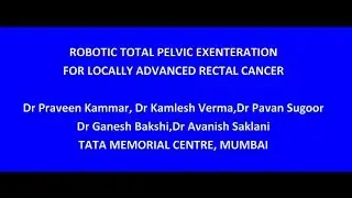 ROBOTIC TOTAL PELVIC EXENTERATION FOR LOCALLY ADVANCED RECTAL CANCER