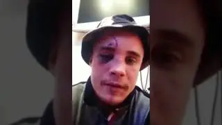 Акаб проиграл бой Марифу Пираеву? | Акаб под веществами рассказал из-за чего проиграл бой.