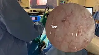 Core Videos (2025): Flexible Cystoscopy Step by Step Video Guide