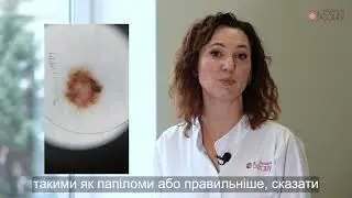 Видалення новоутворень | Олена Кононенко - лікар дерматолог, косметолог