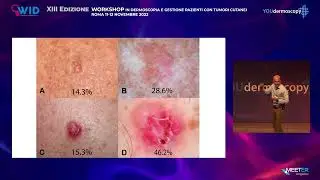 XIII Workshop - A. Lallas - Update pink lesions