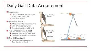 Ming Hao: Mobility Assessment of Sarcopenia Patients