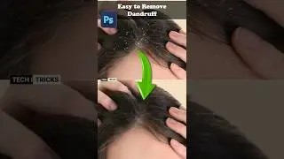 How to remove Dandruff in Photoshop #photoshop #tricks