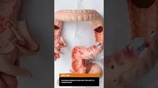 А знали ли вы, что тонкая кишка… #shorts