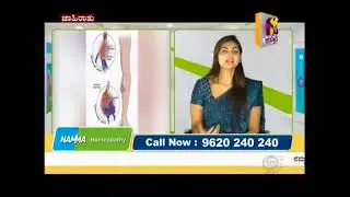 Namma Homeopathy Dr Annapurna Varicose veins