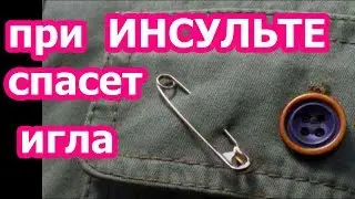 БУЛАВКА может спасти жизнь пациента в случае инсульта #здоровье