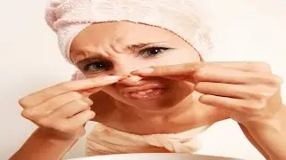 Что будет, если давить прыщи