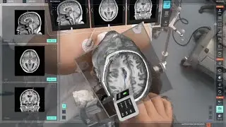 Real-time 3D surgery with Apple Vision Pro 🔇
