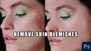 Remove Skin Blemishes in Photoshop tutorial.