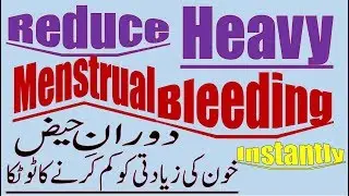 Reduce Heavy Menstrual Bleeding Instantly I Tip To Stop Heavy Menstruation Flow Naturally