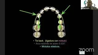 13 Tips exitosos en la práctica de ortodoncia Dr. Esequiel Rodriguez