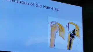 Reverse shoulder arthroplasty