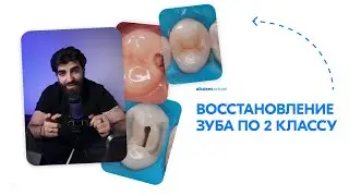 Восстановление зуба. 2 класс по Блэку. Погосян Айк. aikdent.school