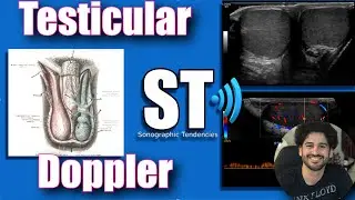 Scrotal/Testicular Doppler Protocol