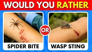 Would You Rather?  30 IMPOSSIBLE Choices in Just 8 Seconds | @QuizUp-Zone