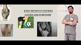 Knee Meniscus Injury causes and symptoms